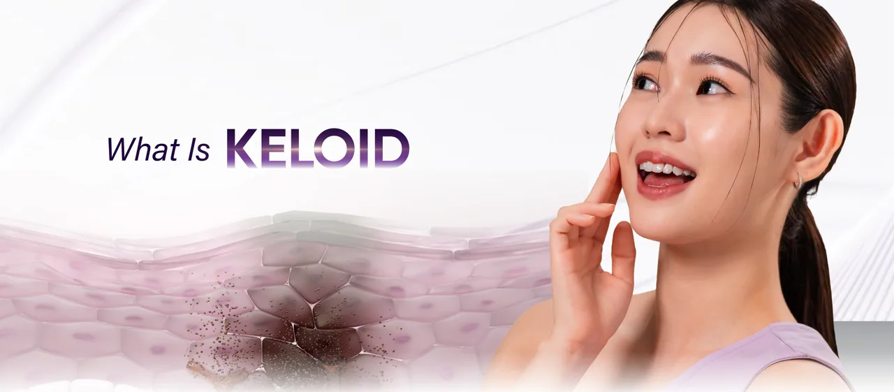 What is Keloid Treatment