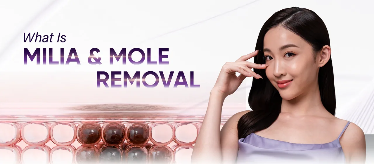 What is Milia and Mole Removal