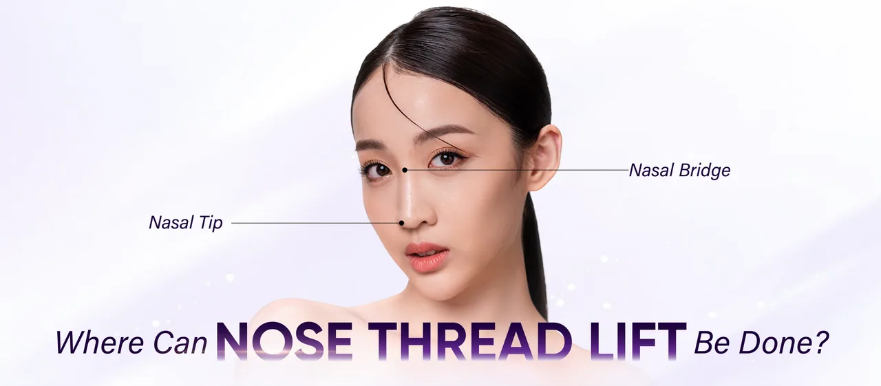 Nose Thread Lift treatment areas
