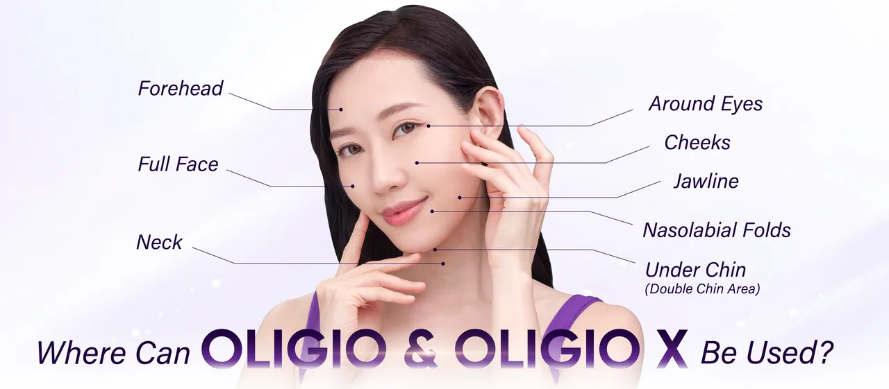 Oligio and Oligio X treatment areas