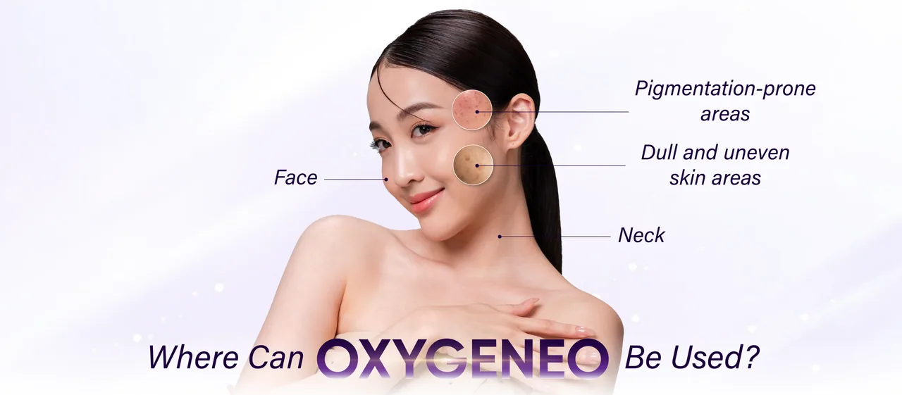 OxyGeneo treatment areas