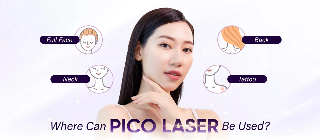 Pico Laser treatment areas