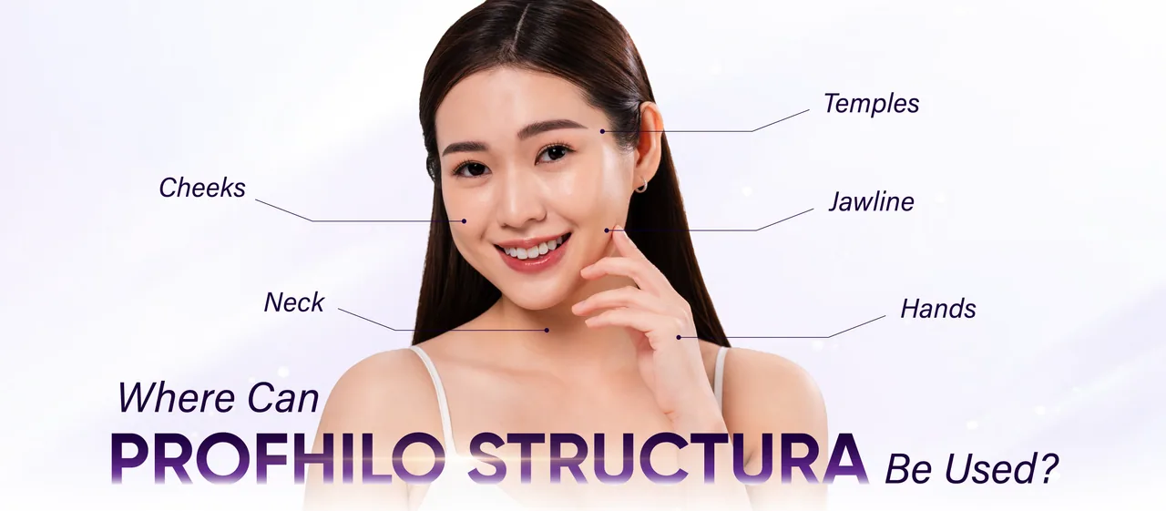 Profhilo Structura treatment areas