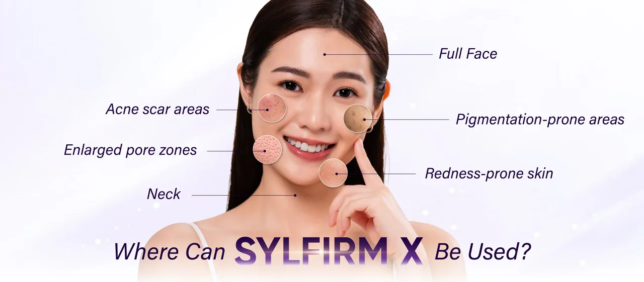 Sylfirm X treatment areas