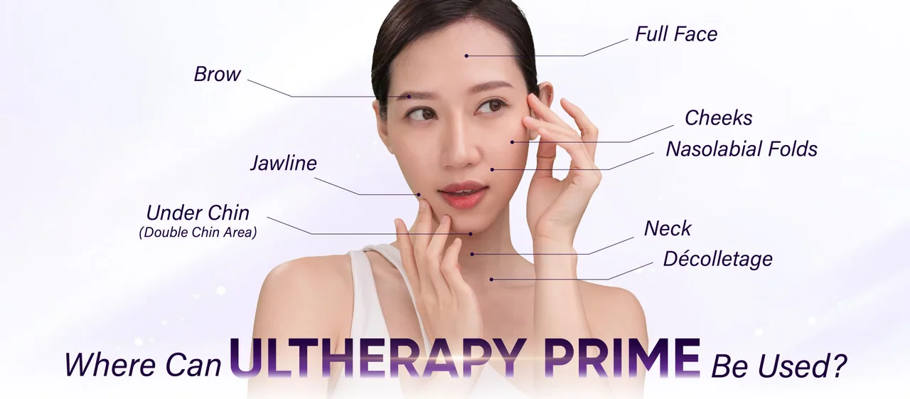 Ultherapy Prime treatment areas