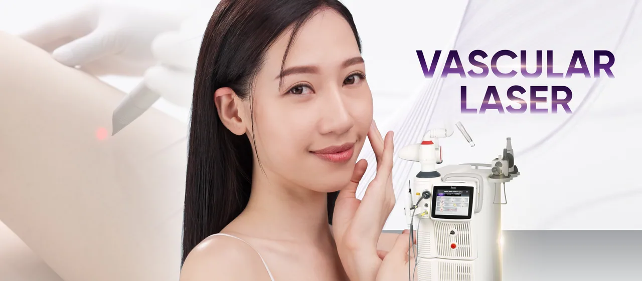 Vascular Laser treatment