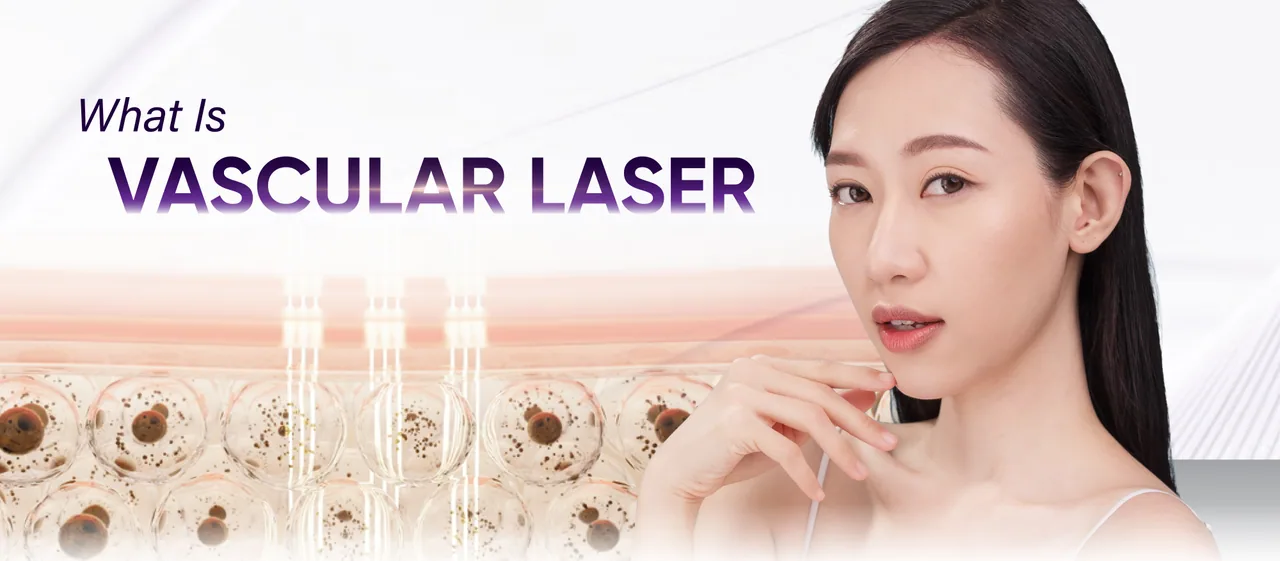 What is Vascular Laser