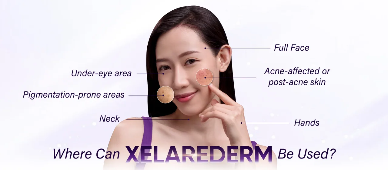 XelaRederm treatment areas