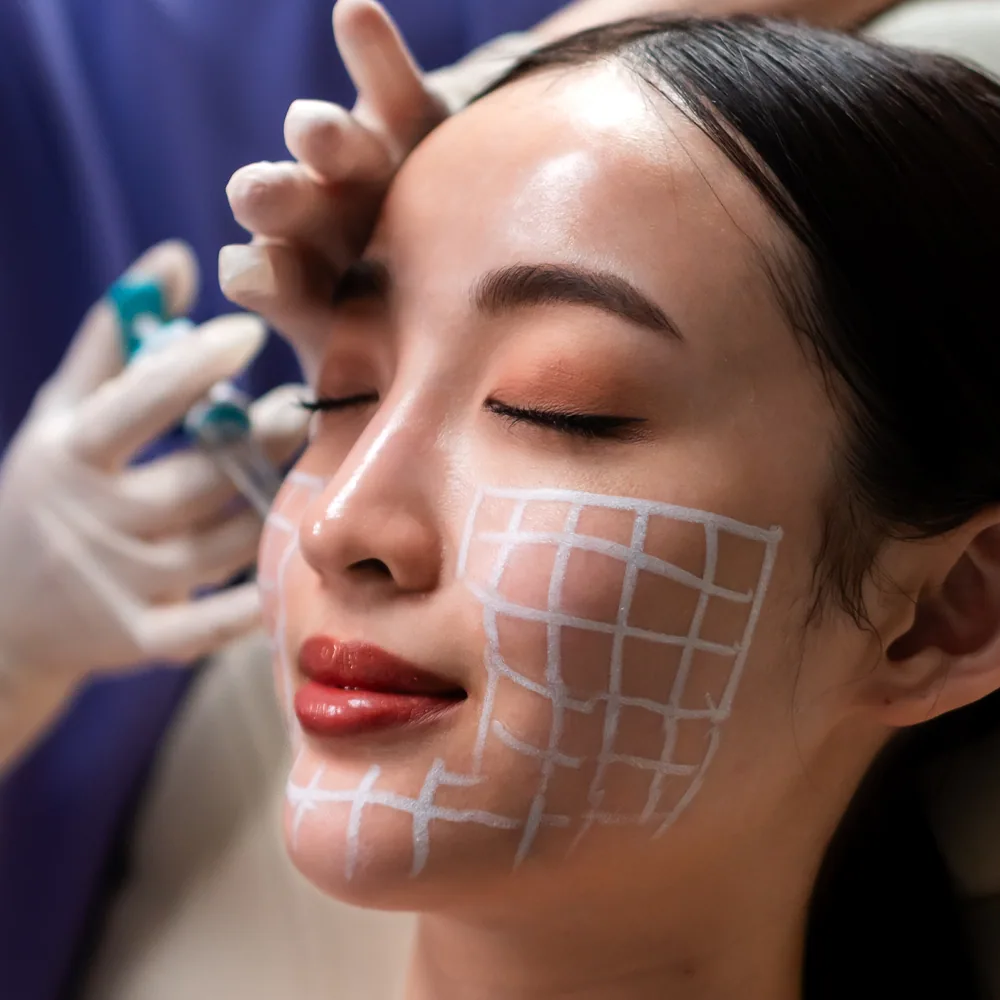 Karisma treatment at Clinic RX
