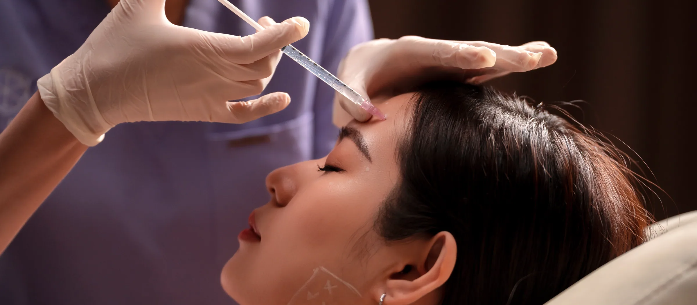 Ellansé treatment in progress