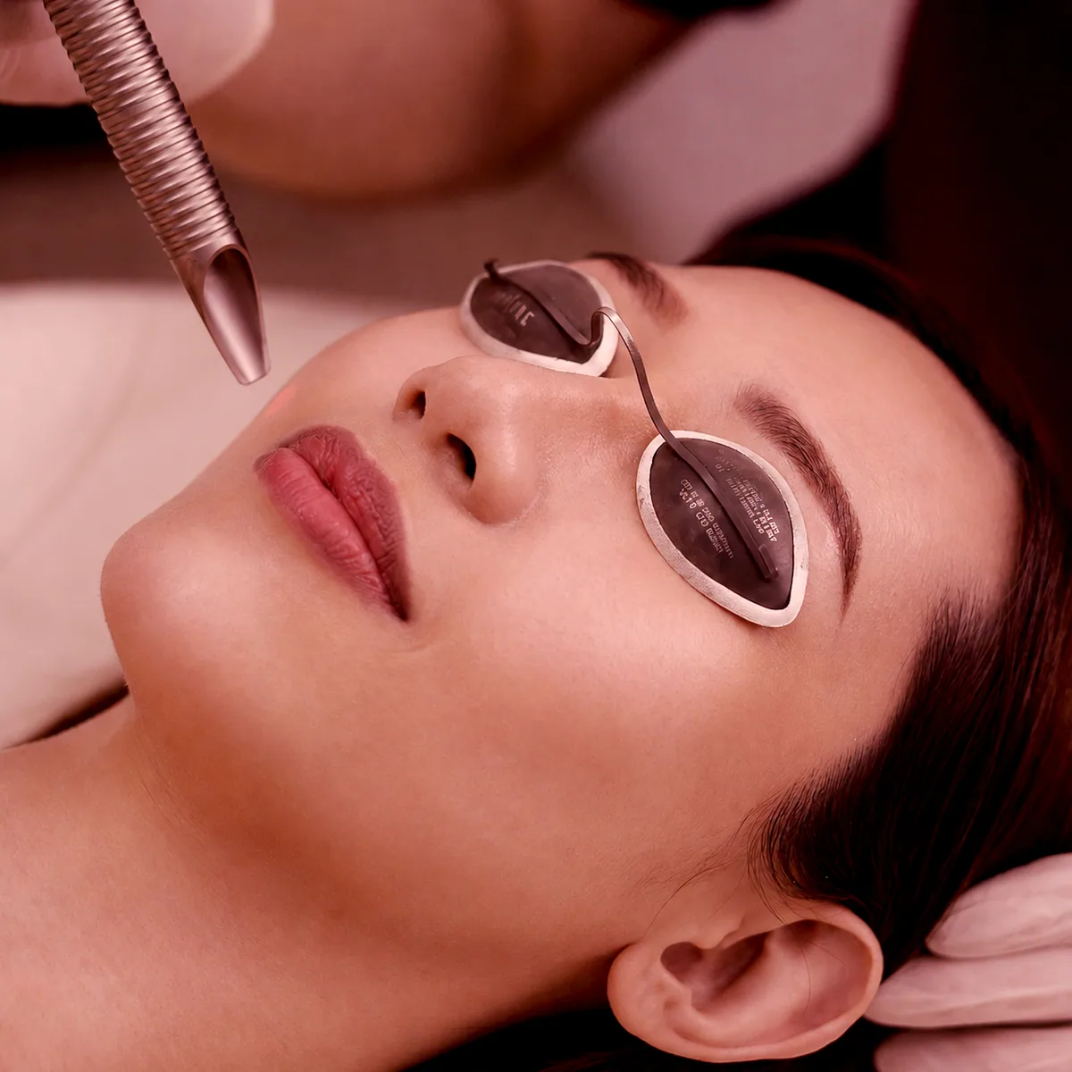 Fotona 4D Lift treatment at Clinic RX