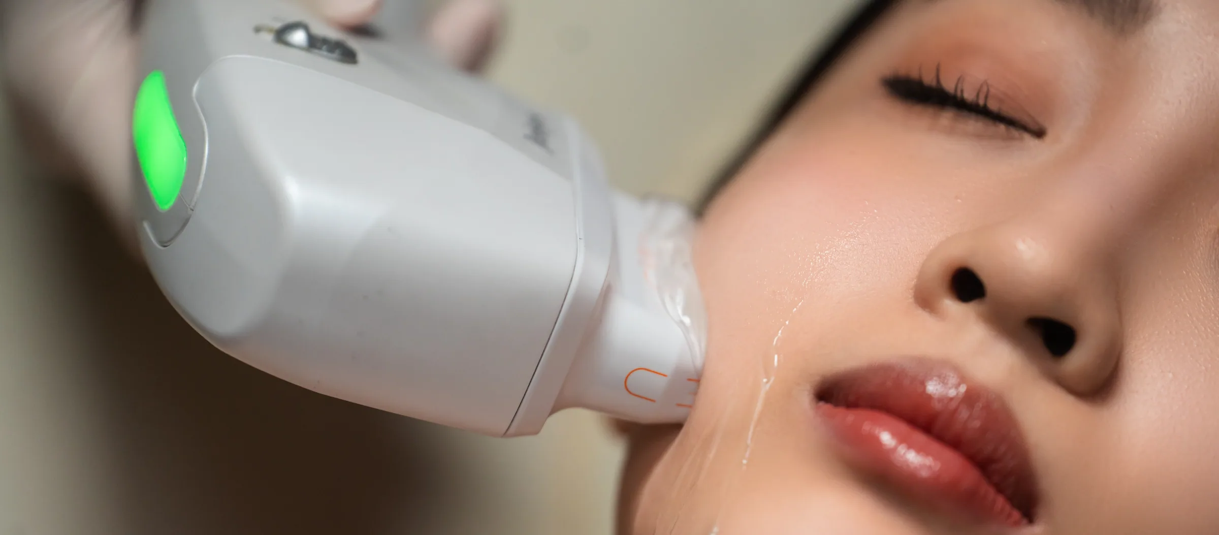 HIFU Ultracel Q+ treatment in progress