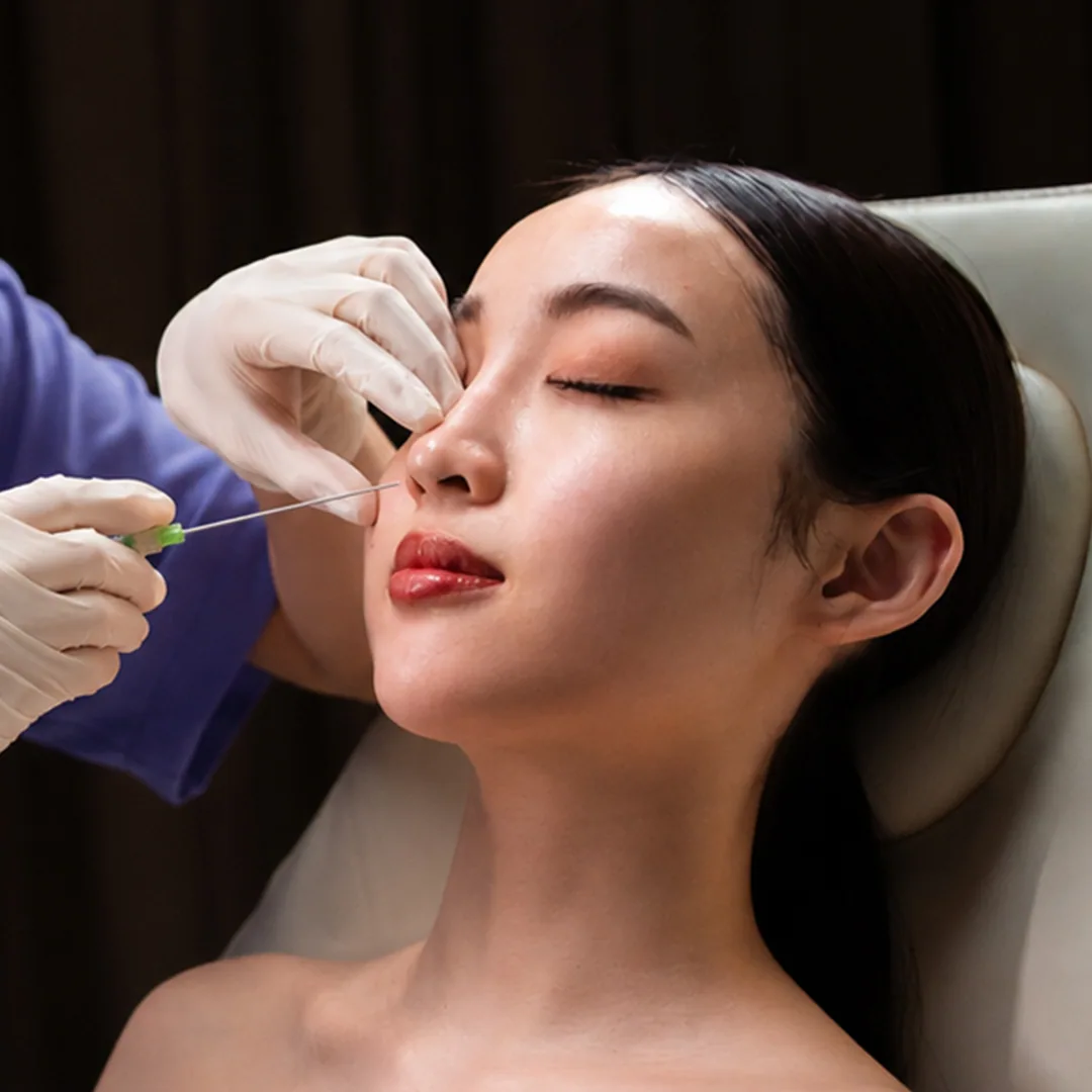 Nose Thread Lift treatment at Clinic RX