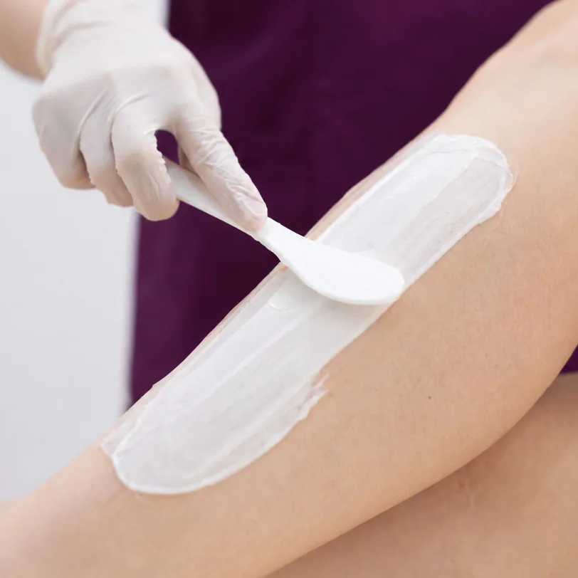 Vascular Laser treatment step 4