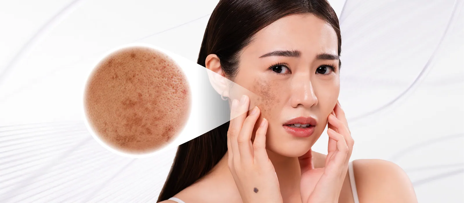 Pigmentation condition overview
