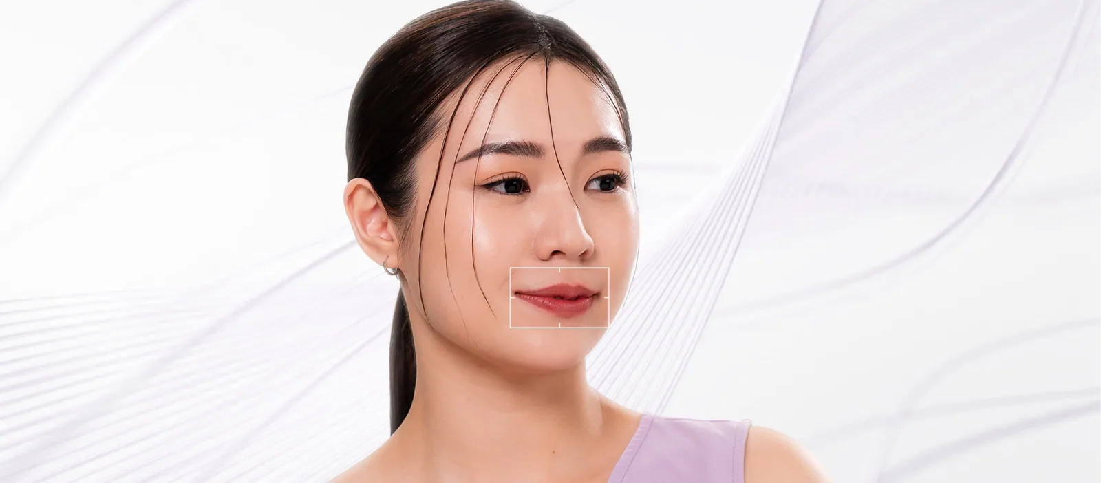 Thin Lips condition overview
