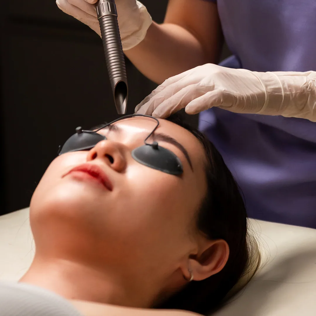 Yellow Laser treatment at Clinic RX