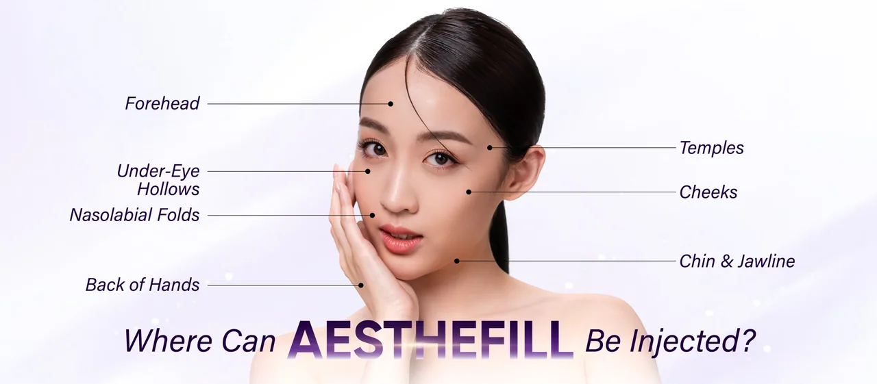 AestheFill treatment areas