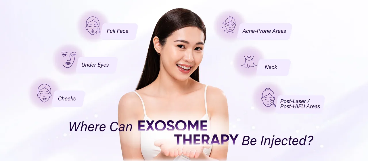 Exosome Therapy treatment areas