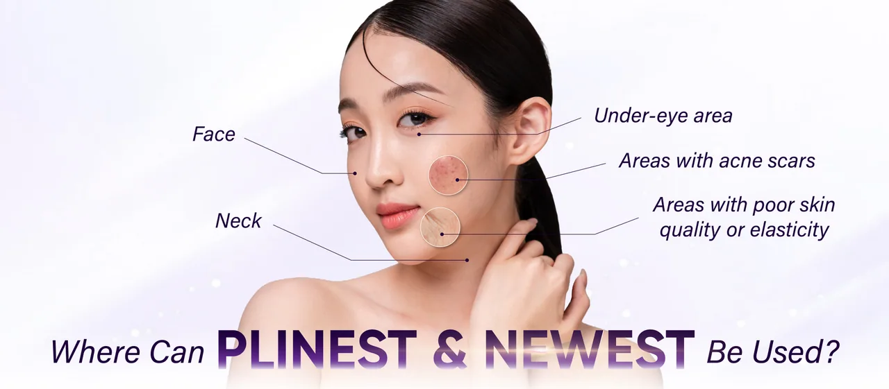 Plinest & Newest treatment areas