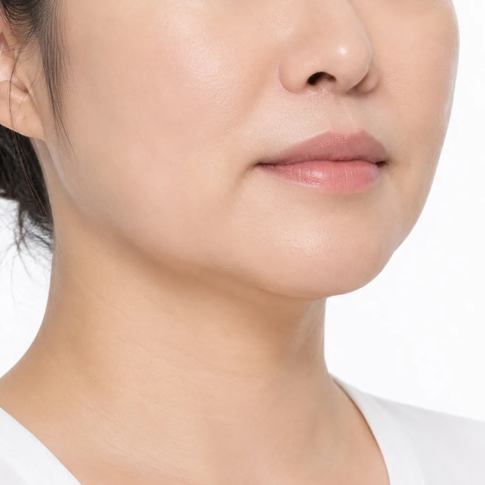 Skin-Related Fullness