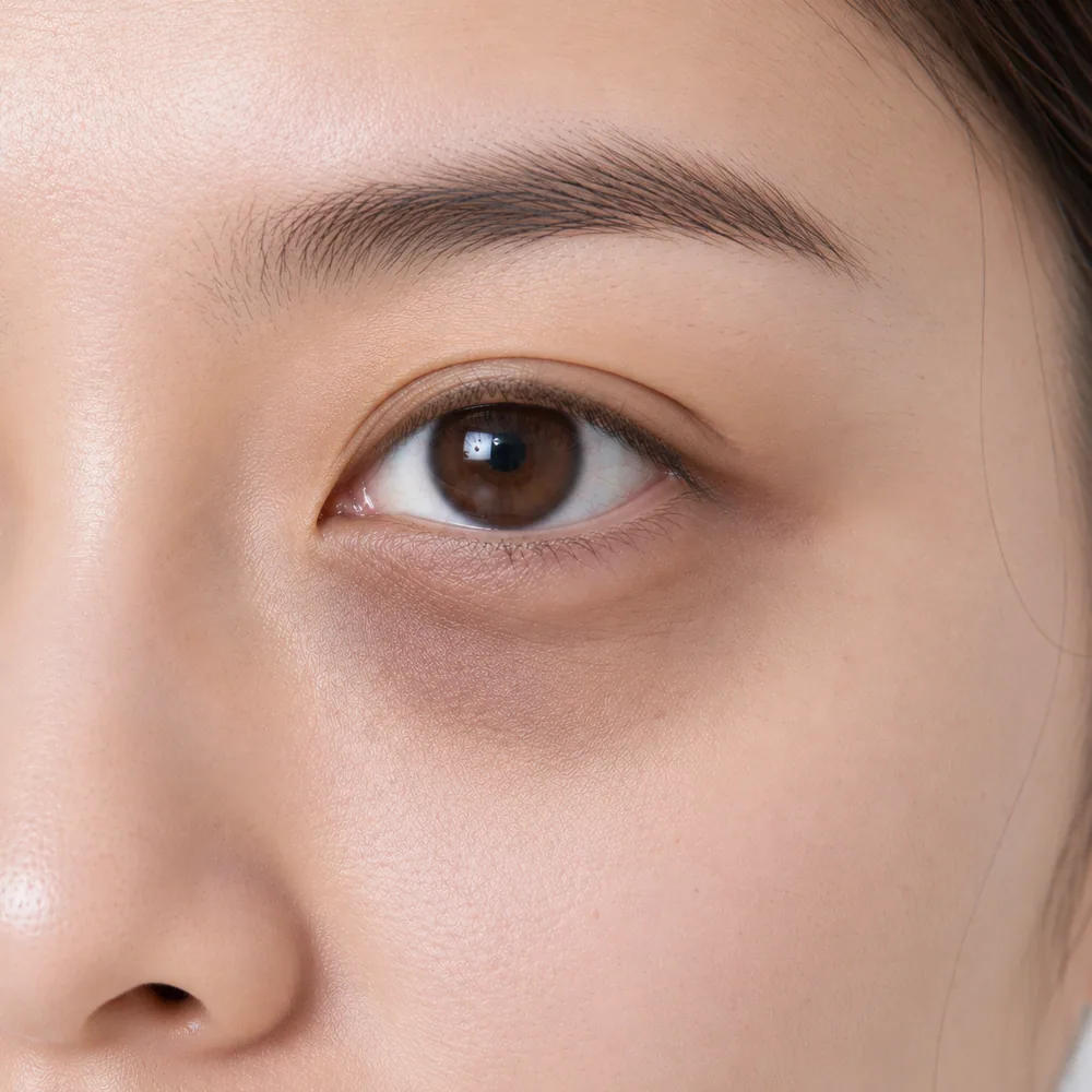 Mixed Dark Circles