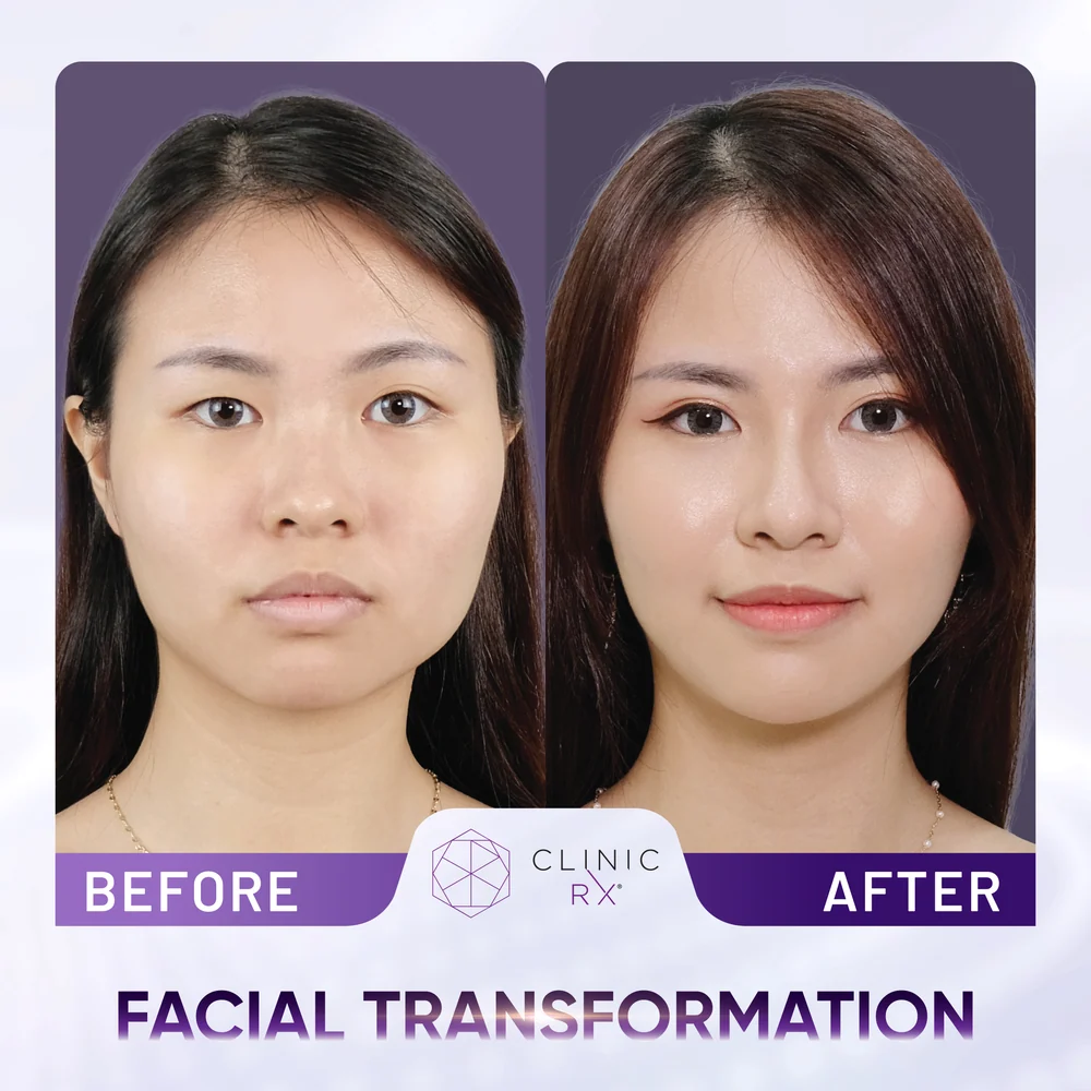 Facial Disharmony result 1
