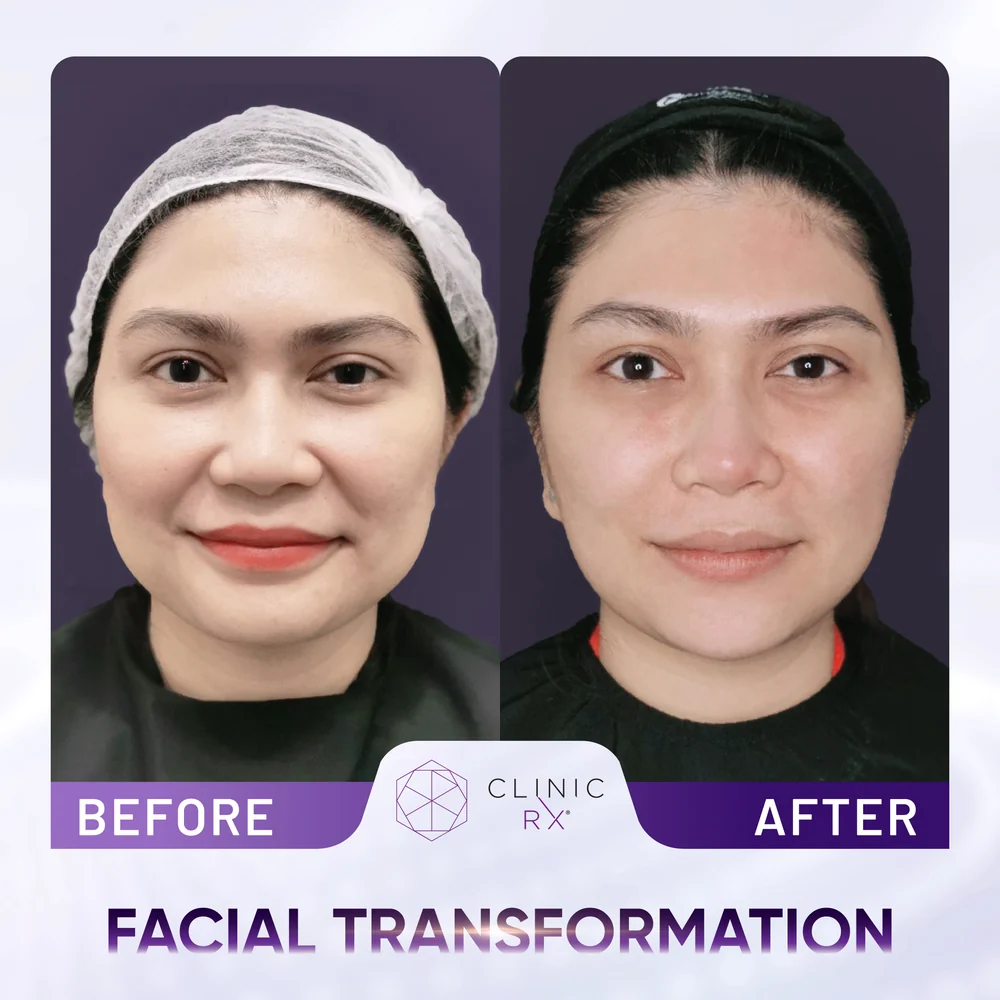 Facial Disharmony result 3