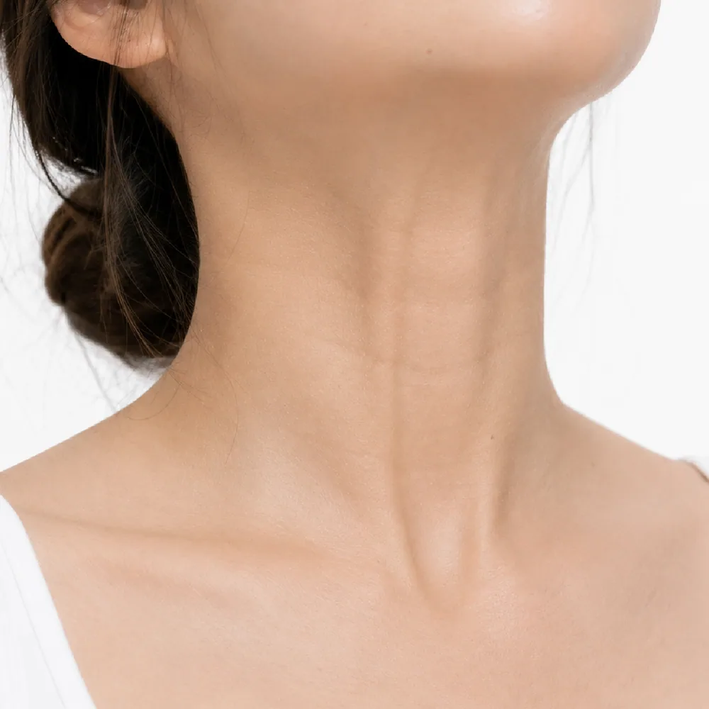 Platysma Bands