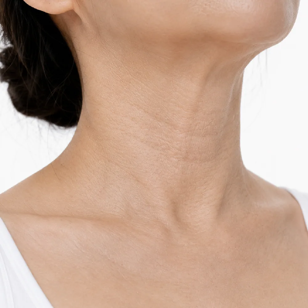 Skin Laxity / Sagging