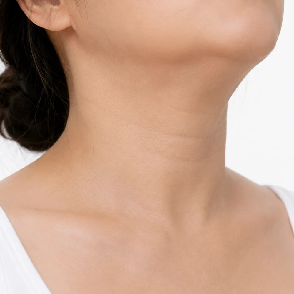 Loss of Jaw-Neck Definition
