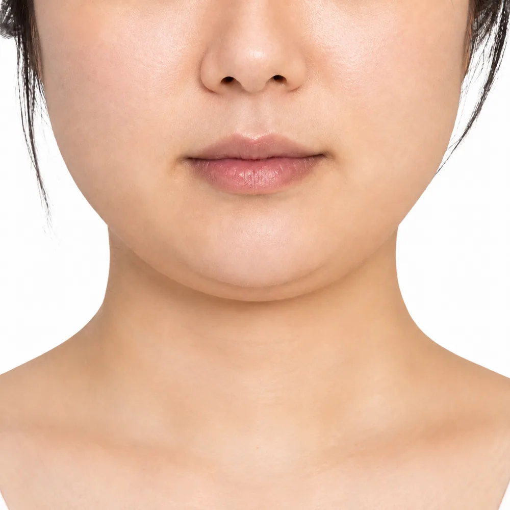 Fat-Related Jaw Width