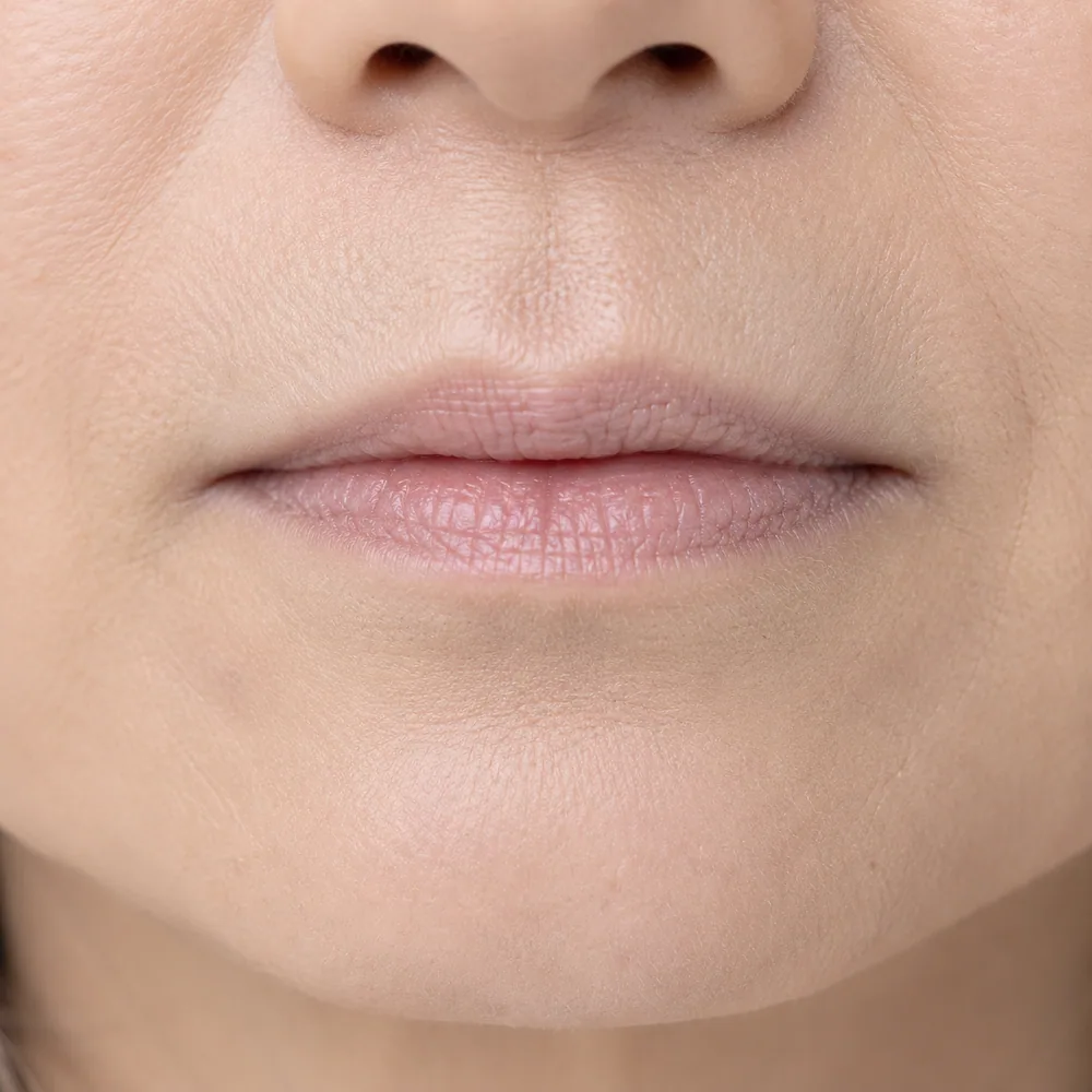 Age-Related Volume Loss