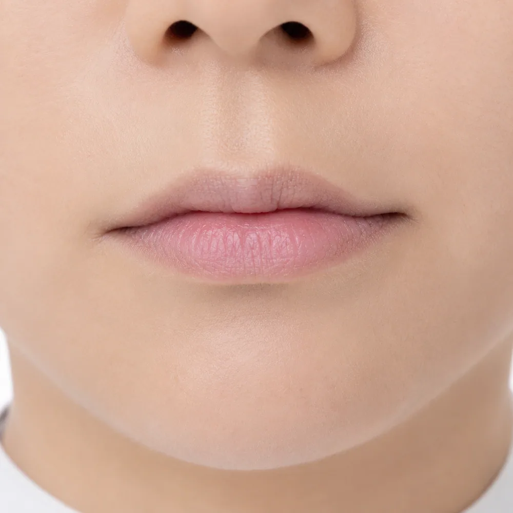 Asymmetric Lips