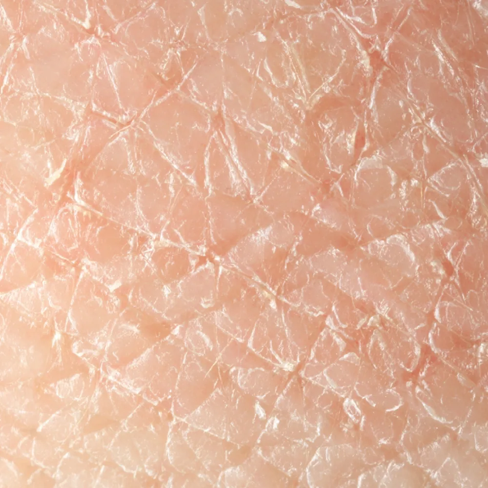 Bumpy / Congested Texture