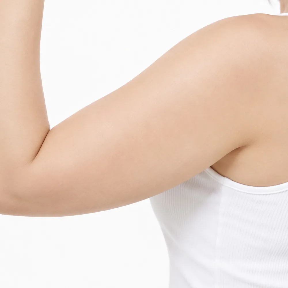 Upper Arms