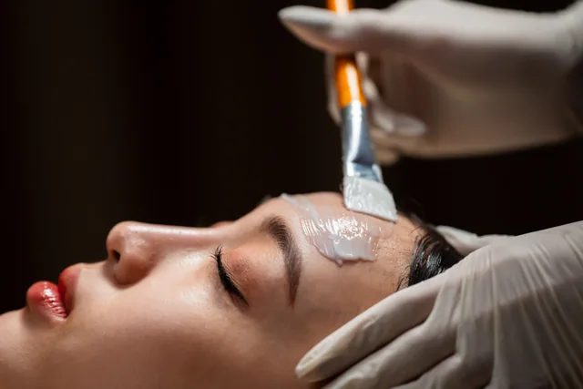 AestheFill treatment step 3