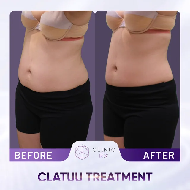 Clatuu actual result 1