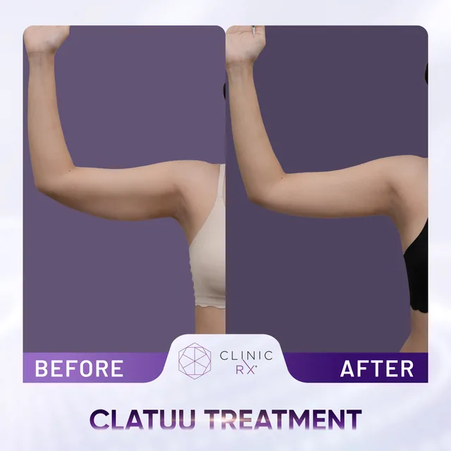 Clatuu actual result 2