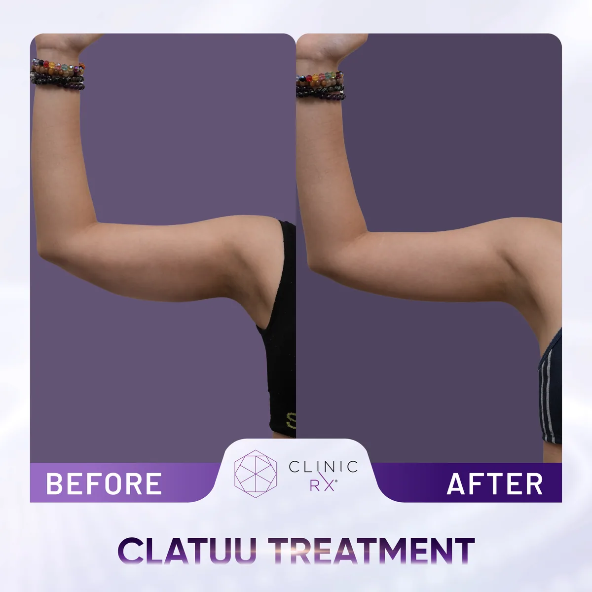 Clatuu actual result 3