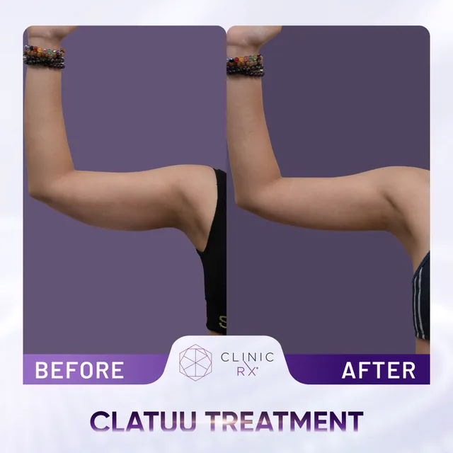 Clatuu actual result 3