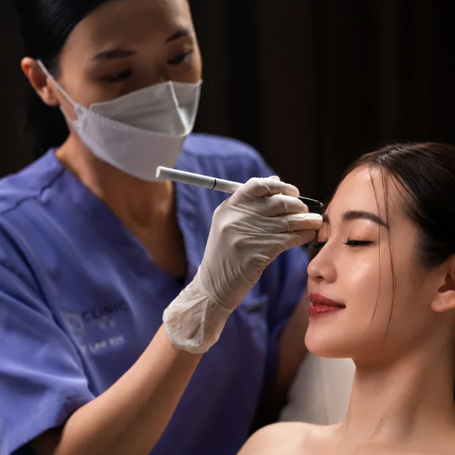 Ellansé treatment step 2