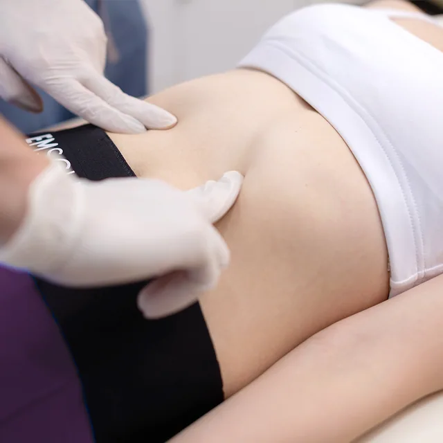 Emsculpt treatment step 1