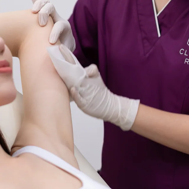 HIFU Body treatment step 2