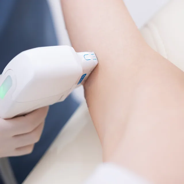 HIFU Body treatment step 3