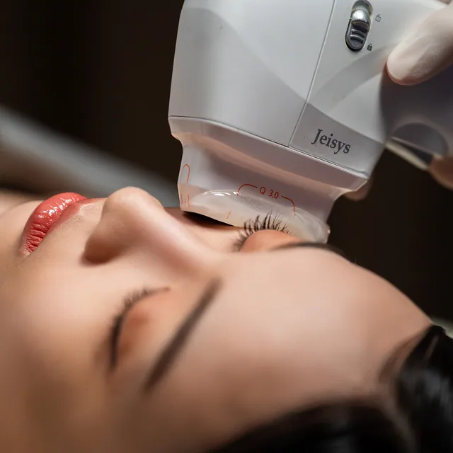 HIFU Ultracel Q+ treatment step 3