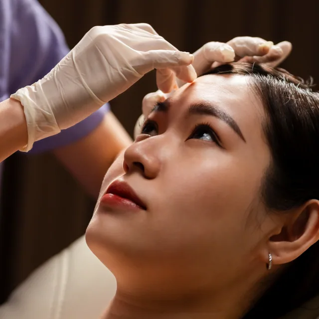 Keloid Treatment treatment step 2