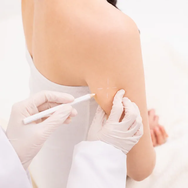 Lipo Body treatment step 2