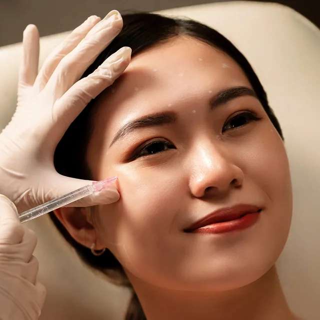 Profhilo treatment step 3