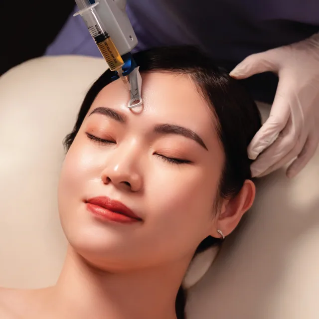 PRP Treatment treatment step 4